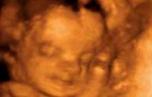 Седьмой месяц беременности: развитие ребенка Семь с половиной месяцев беременности